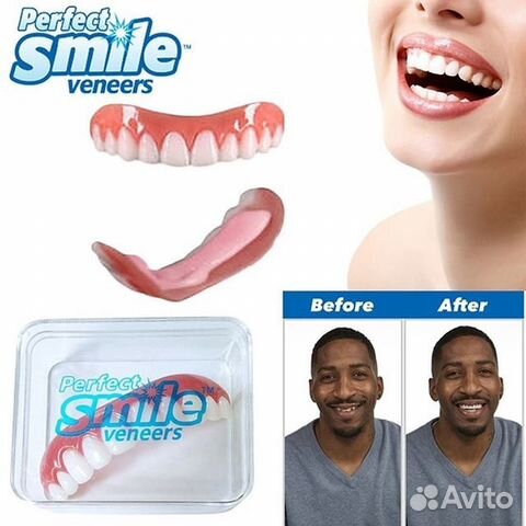 Виниры Snap on Smile Виниры Snap on Smile