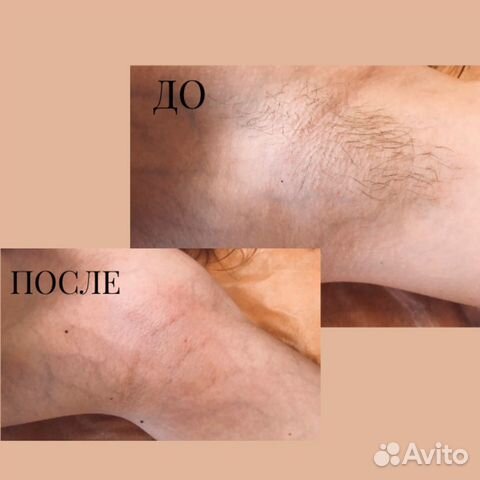 Шугаринг и воск Шугаринг и воск